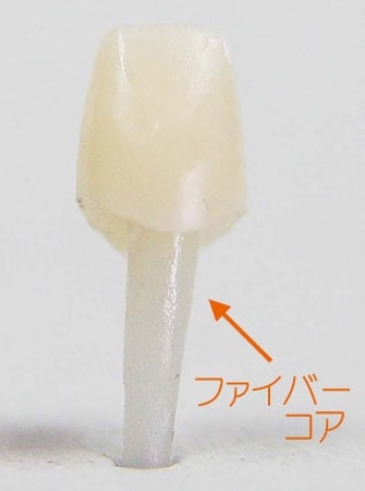 ファイバーコアの写真